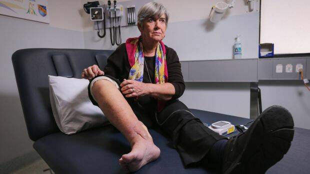 Sandra Hocking shows her healing superbug wound at the Austin Hospital.  Photo: Wayne Taylor