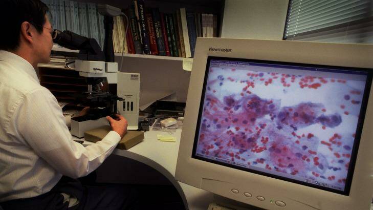 A pathologist analyses an abnormal Pap smear. Photo: Eamon Gallagher